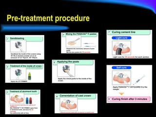Pre-treatment procedure 