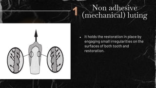 Non adhesive
(mechanical) luting
● It holds the restoration in place by
engaging small irregularities on the
surfaces of b...