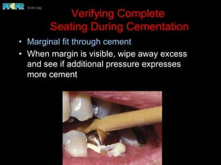 Dental cements and cementation procedures | PDF