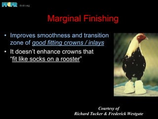 Marginal Finishing
•  Improves smoothness and transition
zone of good fitting crowns / inlays
•  It doesn’t enhance crowns that
“fit like socks on a rooster”
Courtesy of
Richard Tucker & Frederick Westgate
 