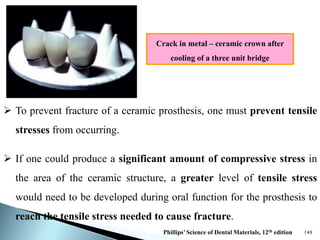 Dental Ceramics