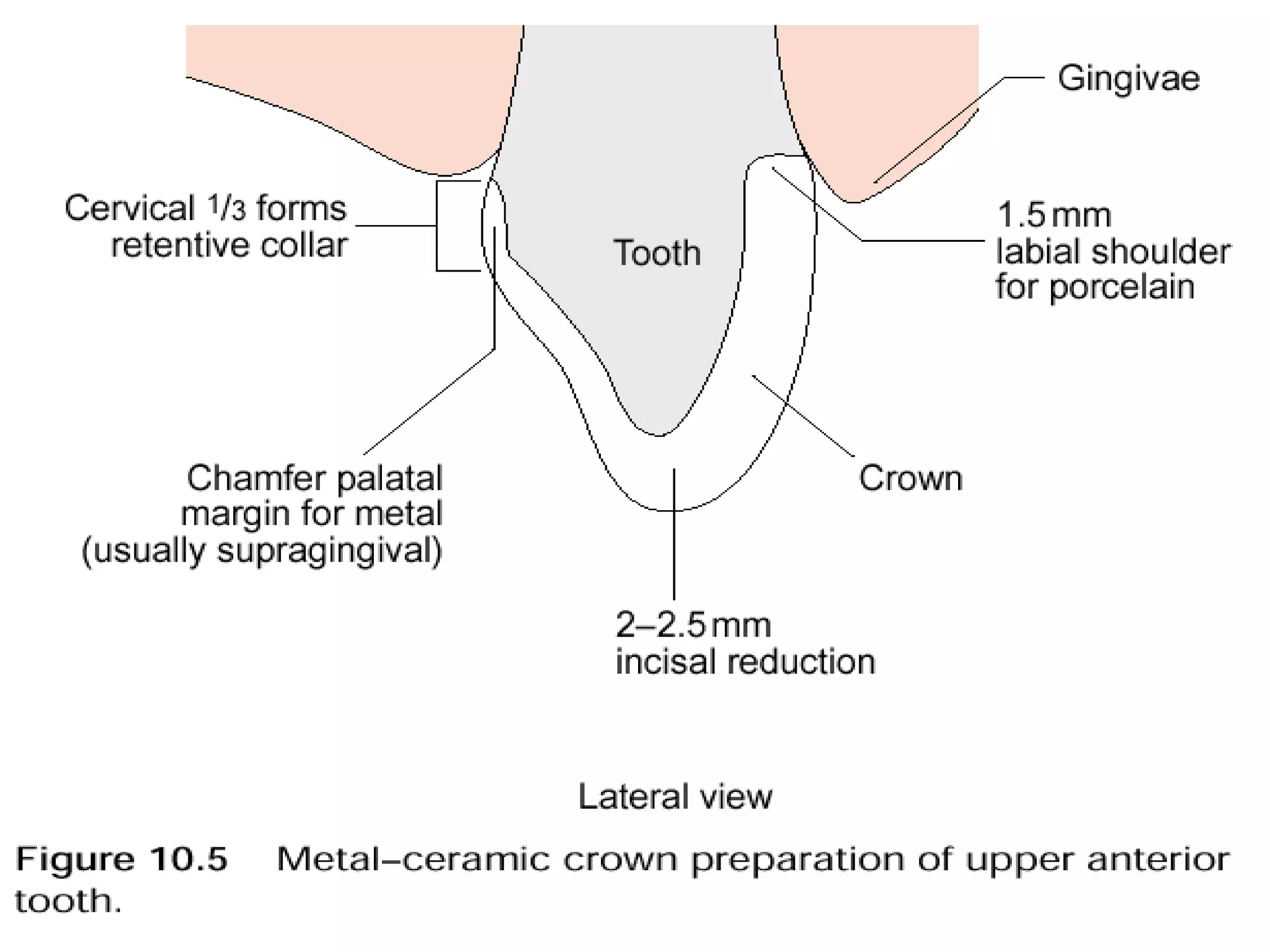 Dental ceramic & cad cam | PPT
