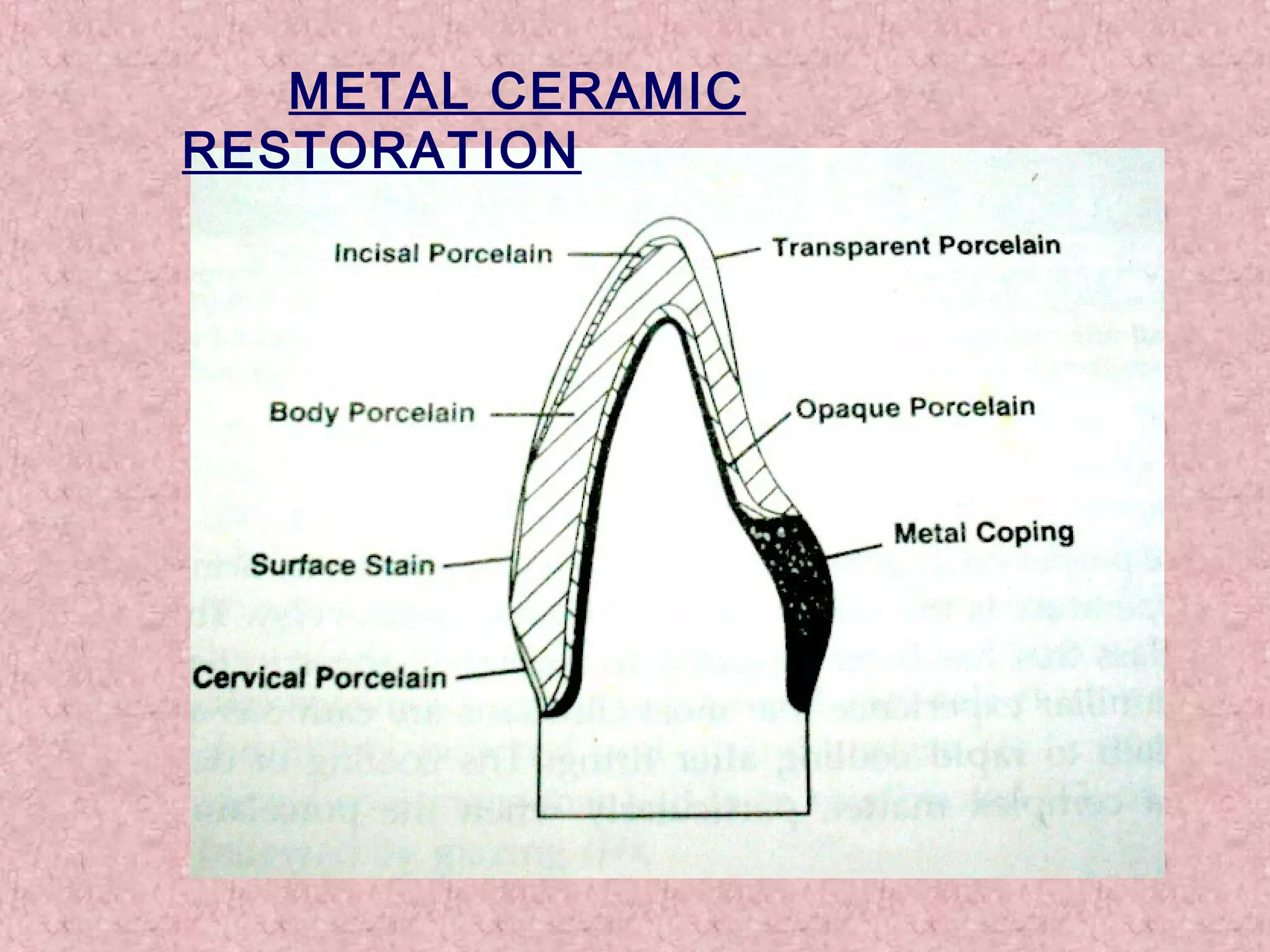 Dental ceramic & cad cam | PPT