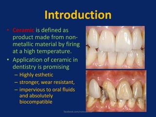 Introduction
• Ceramic is defined as
product made from non-
metallic material by firing
at a high temperature.
• Application of ceramic in
dentistry is promising
– Highly esthetic
– stronger, wear resistant,
– impervious to oral fluids
and absolutely
biocompatible
facebook.com/notesdental
 