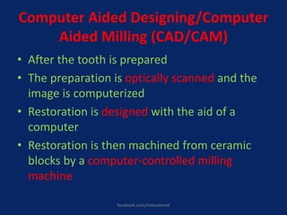 Computer Aided Designing/Computer
Aided Milling (CAD/CAM)
• After the tooth is prepared
• The preparation is optically scanned and the
image is computerized
• Restoration is designed with the aid of a
computer
• Restoration is then machined from ceramic
blocks by a computer-controlled milling
machine
facebook.com/notesdental
 