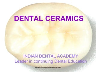 DENTAL CERAMICS
INDIAN DENTAL ACADEMY
Leader in continuing Dental Education
www.indiandentalacademy.com
 