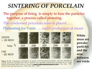 SINTERING OF PORCELAIN
The purpose of firing is simply to fuse the particles
together, a process called sintering.
The con...