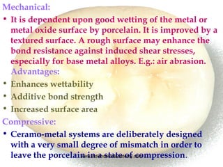 Mechanical:
• It is dependent upon good wetting of the metal or
metal oxide surface by porcelain. It is improved by a
text...