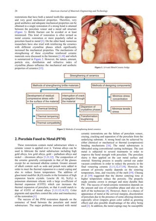 Dental ceramics | PDF