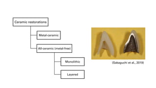 Dental ceramics | PDF