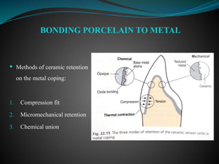  Methods of ceramic retention
on the metal coping:
1. Compression fit
2. Micromechanical retention
3. Chemical union
BONDING PORCELAIN TO METAL
 