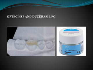 OPTEC HSPAND DUCERAM LFC
 