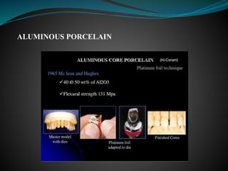 ALUMINOUS PORCELAIN
 
