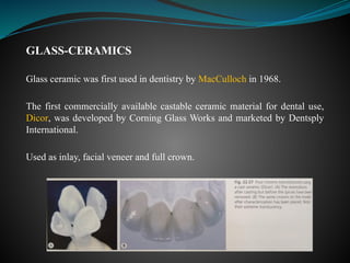 GLASS-CERAMICS
Glass ceramic was first used in dentistry by MacCulloch in 1968.
The first commercially available castable ceramic material for dental use,
Dicor, was developed by Corning Glass Works and marketed by Dentsply
International.
Used as inlay, facial veneer and full crown.
 