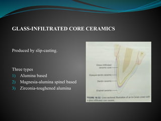 GLASS-INFILTRATED CORE CERAMICS
Produced by slip-casting.
Three types
1) Alumina based
2) Magnesia-alumina spinel based
3) Zirconia-toughened alumina
 