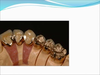 Dental Ceramics types and manufacturing dentistry | PPT