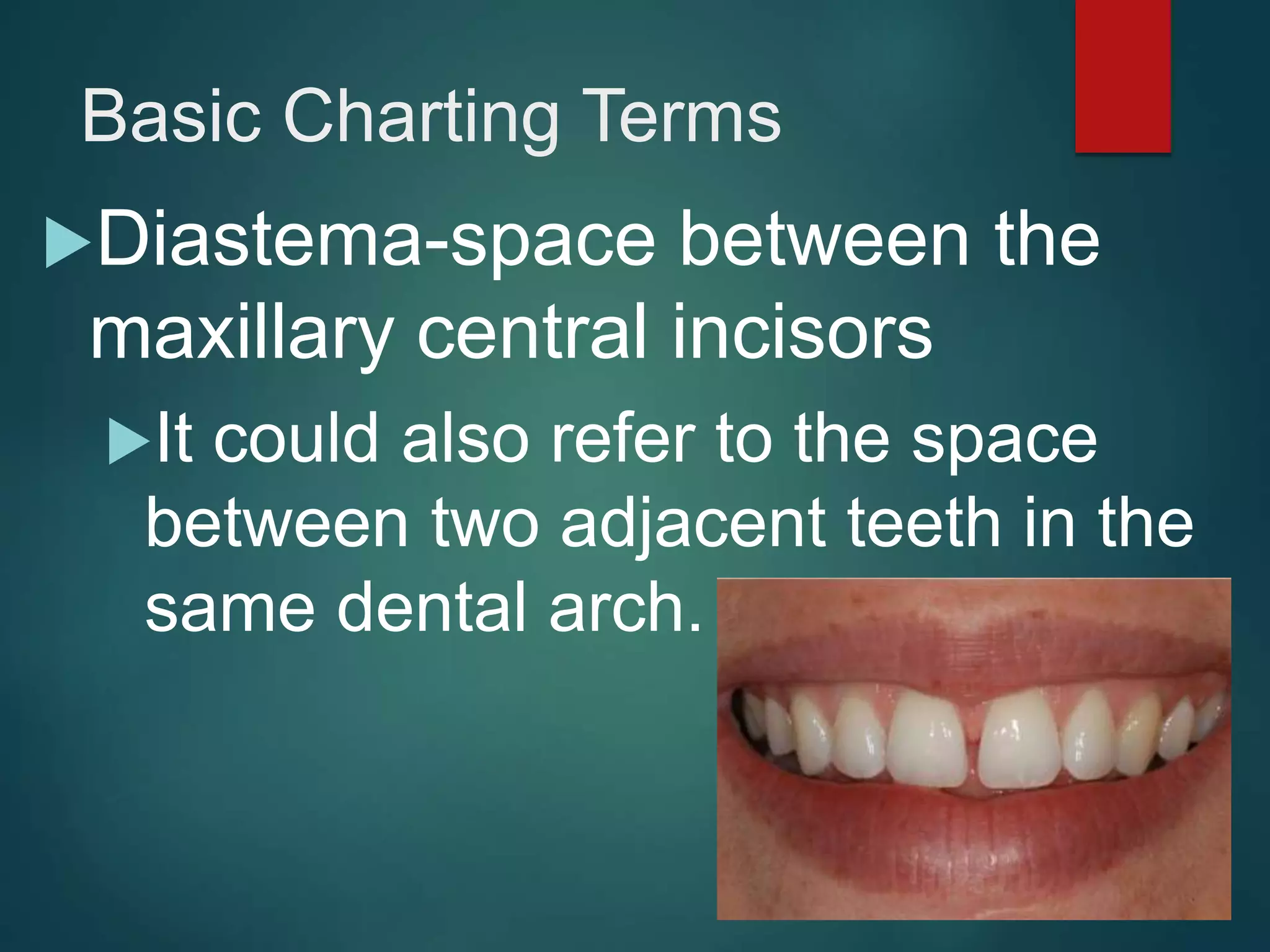 Basic Charting Terms
Diastema-space between the
maxillary central incisors
It could also refer to the space
between two adjacent teeth in the
same dental arch.
 
