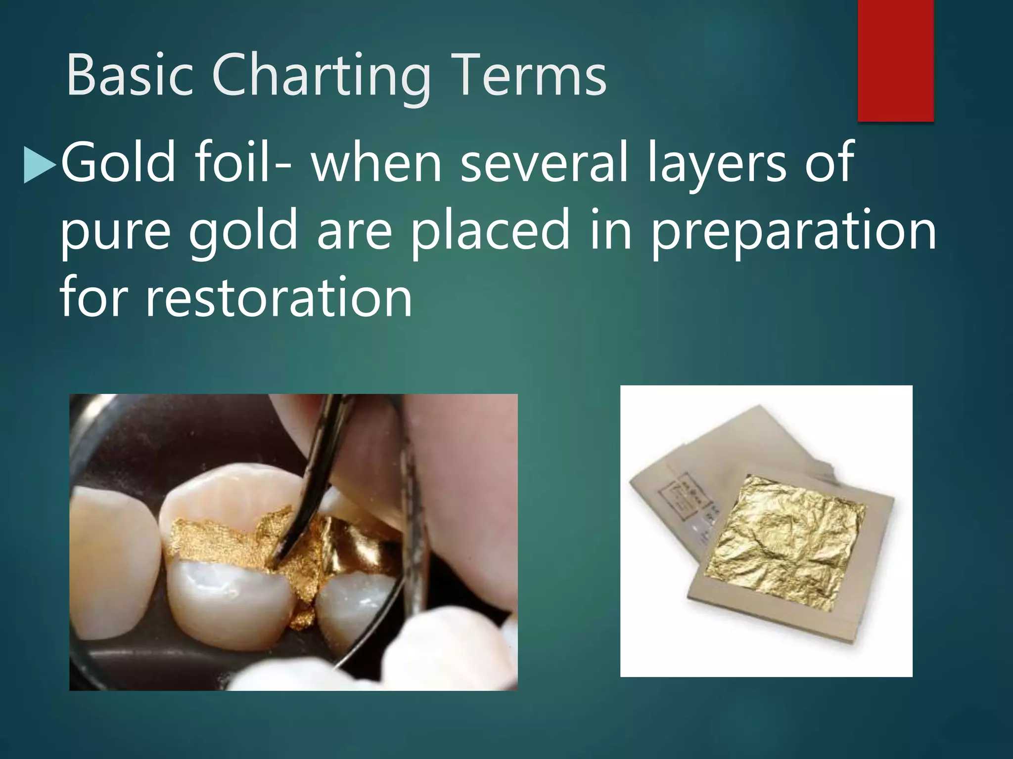 Basic Charting Terms
Gold foil- when several layers of
pure gold are placed in preparation
for restoration
 