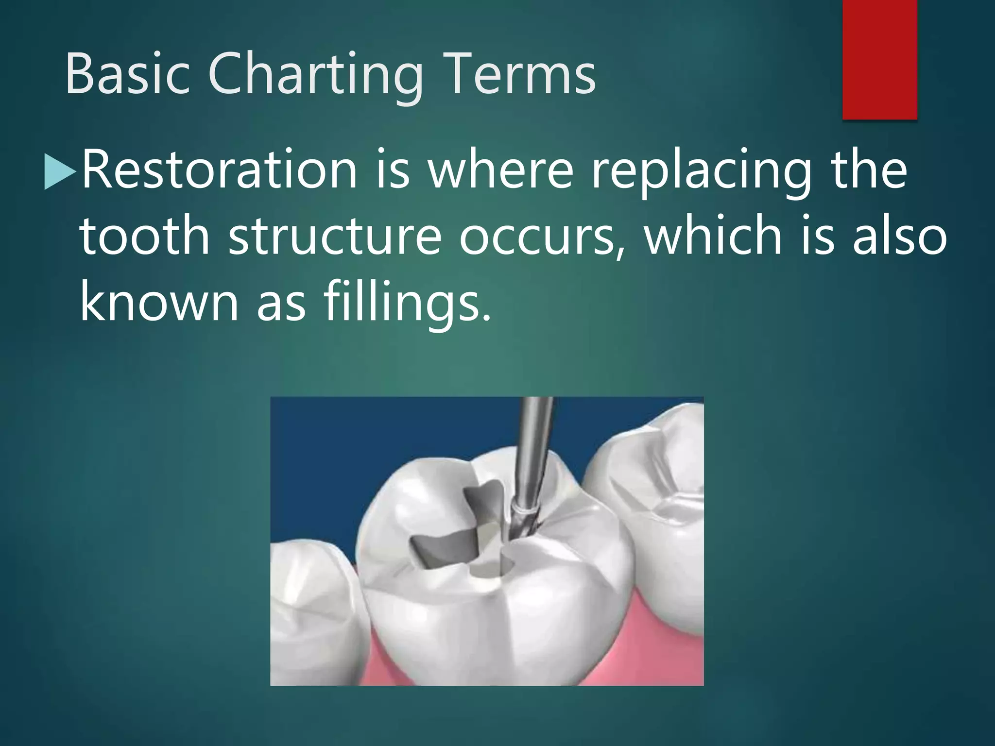 Basic Charting Terms
Restoration is where replacing the
tooth structure occurs, which is also
known as fillings.
 