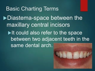 Basic Charting Terms
Diastema-space between the
maxillary central incisors
It could also refer to the space
between two adjacent teeth in the
same dental arch.
 