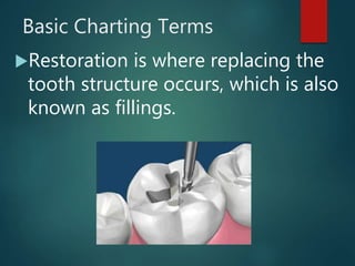 Basic Charting Terms
Restoration is where replacing the
tooth structure occurs, which is also
known as fillings.
 