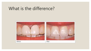 What is the difference?
 