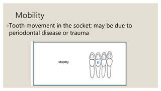Mobility
◦Tooth movement in the socket; may be due to
periodontal disease or trauma
 