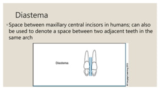 Diastema
◦Space between maxillary central incisors in humans; can also
be used to denote a space between two adjacent teeth in the
same arch
 