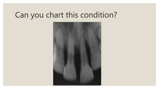Can you chart this condition?
 