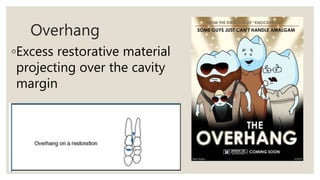 Overhang
◦Excess restorative material
projecting over the cavity
margin
 