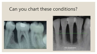 Can you chart these conditions?
 