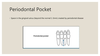 Periodontal Pocket
◦ Space in the gingival sulcus (beyond the normal 1-3mm) created by periodontal disease
 
