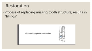 Restoration
◦Process of replacing missing tooth structure; results in
“fillings”
 