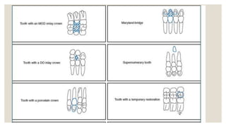 15+ Charting Dental Symbols