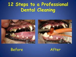 12 Steps to a Professional Dental Cleaning   Before                        After     