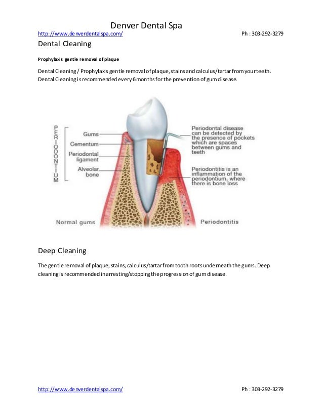 Dental Cleaning Services, Patient Education Teeth Whitening Treatment