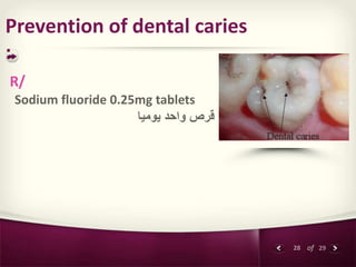 28 of 29
Prevention of dental caries
:
R/
Sodium fluoride 0.25mg tablets
‫يوميا‬ ‫واحد‬ ‫قرص‬
 
