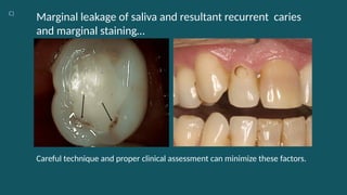 Dental Composite Material and information | PPTX