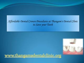 Affordable Dental Crown Procedures at Thangam's Dental Clinic
                     to Save your Teeth
 