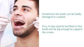 Sometimes the tooth can be badly
damaged or cracked.
If so, it may need to be filled so the
tooth will be big enough to support
the crown.
 