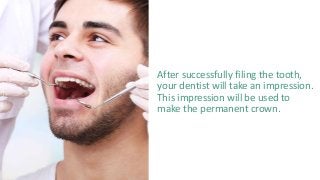After successfully filing the tooth,
your dentist will take an impression.
This impression will be used to
make the permanent crown.
 