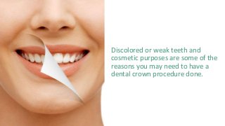 Discolored or weak teeth and
cosmetic purposes are some of the
reasons you may need to have a
dental crown procedure done.
 