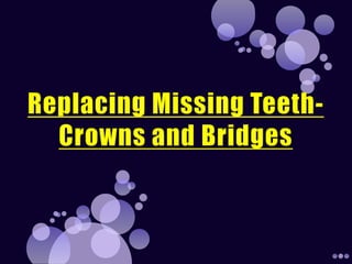 Replacing Missing Teeth- Crowns and Bridges