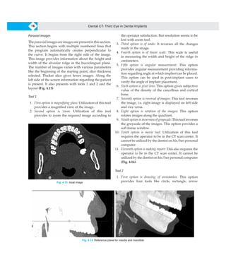 Dental CT_ Third Eye in Dental Implants ( PDFDrive ).pdf