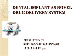 DENTAL IMPLANT AS NOVELDENTAL IMPLANT AS NOVEL
DRUG DELIVERY SYSTEMDRUG DELIVERY SYSTEM
PRESENTED BY
SUDHANSHU GANGWAR
M.PHARM 1st
year
 