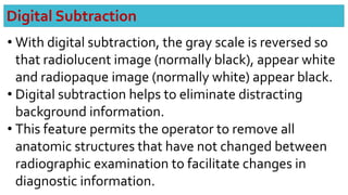 Dental digital radiography | PPTX