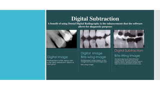 Dental digital radiography | PPTX
