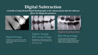 Digital Subtraction
A benefit of using Dental Digital Radiography is the enhancements that the software
allows for diagnostic purposes
Digital Image
Radiopaque (white areas) with
outer area radiolucent (black or
dark gray)
Digital Image
Bite-wing Image
Radiopaque (white areas) as first
image and as normal image view
Bite-wing Image
Digital Subtraction
Bite-Wing Image
This digital image has the Digital Subtraction
enhancement done after image stored on the
computer software. It reverses the shades of gray for
diagnostic purposes. Radiopaque (normally white
images are now looking translucent (dark or gray)
 