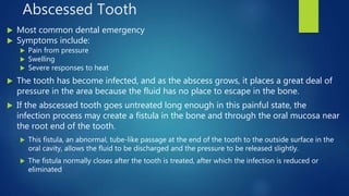 Chapter 16: Dental Emergencies | PPTX