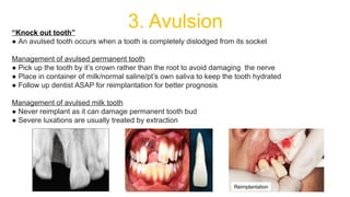 Tooth Avulsion Project DENTAL EMERGENCYyyyyyyyyyyyyyyyyyyyyyyyyy | PPTX